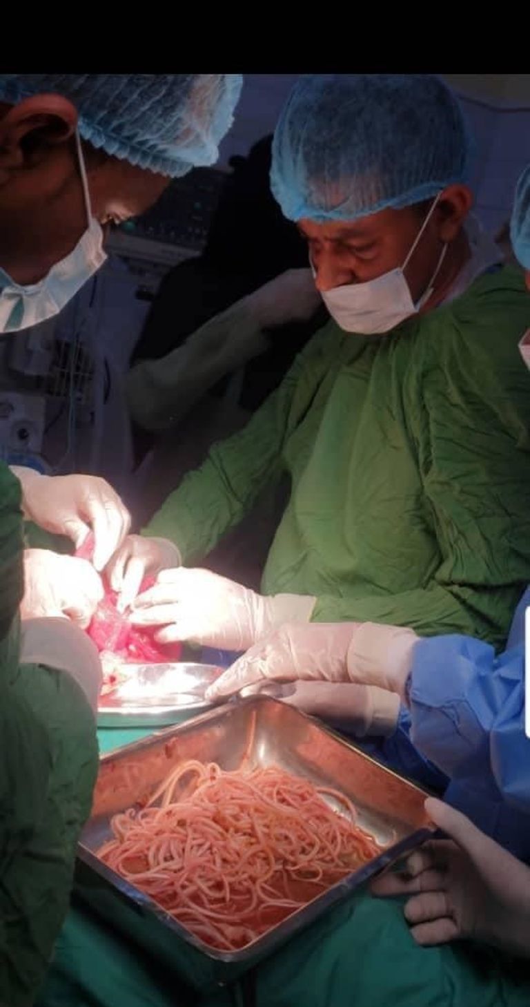 الديدان عاشت في أمعاء الطفل لسنوات