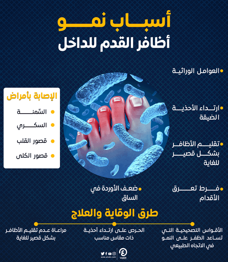 أسباب نمو أظافر القدم للداخل