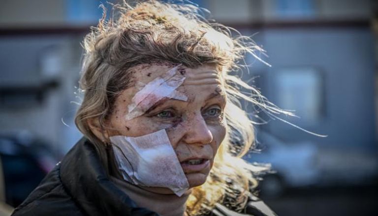 أوكرانية مصابة بجروح جراء قصف روسي 