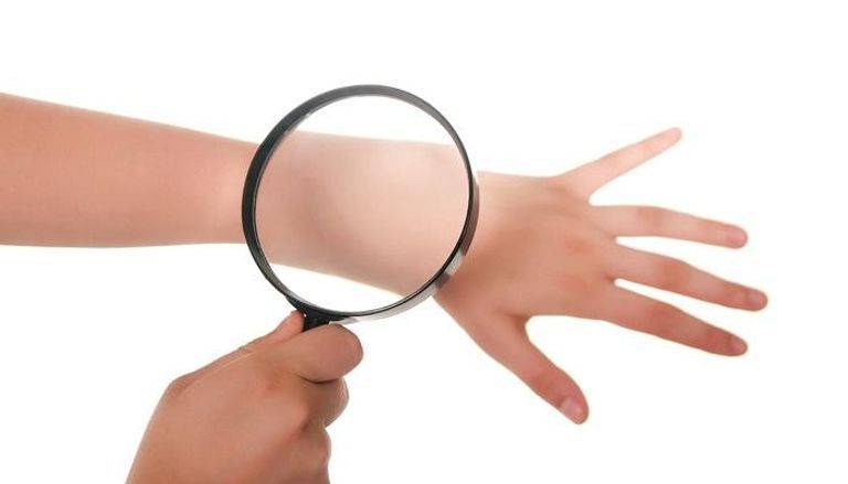 التشخيص المبكر يرفع فرص نجاح علاج سرطان الجلد