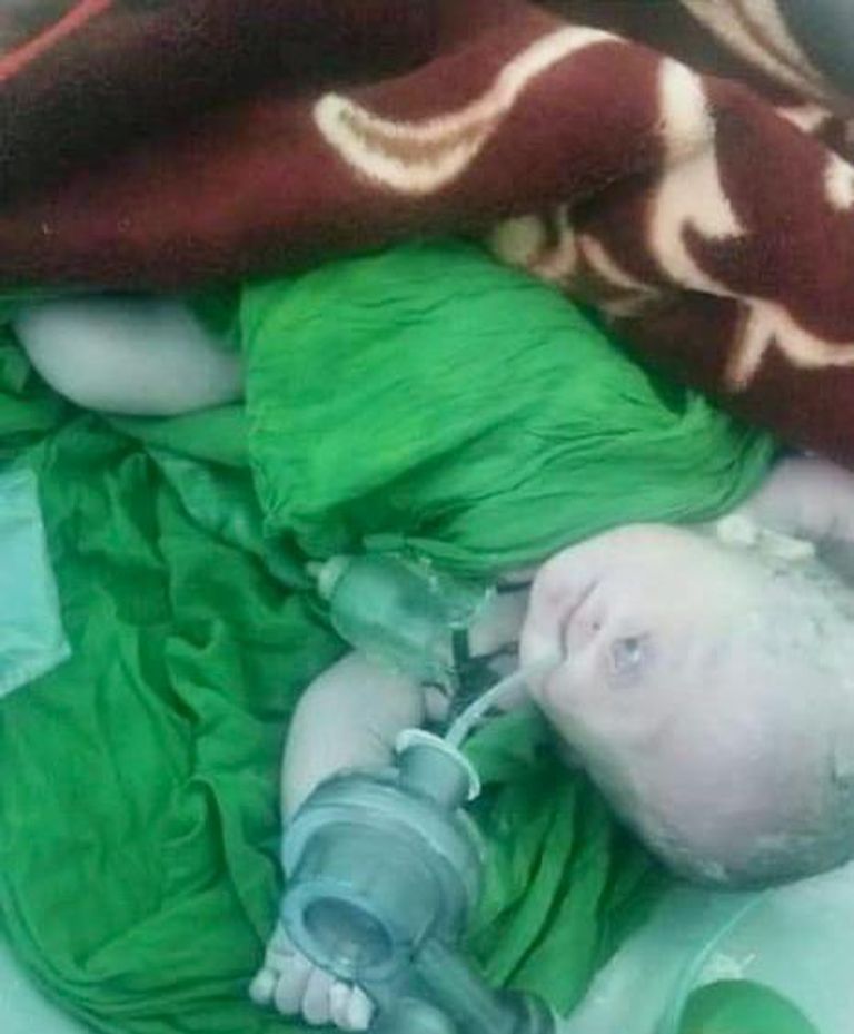 الطفل ذو العين الواحدة