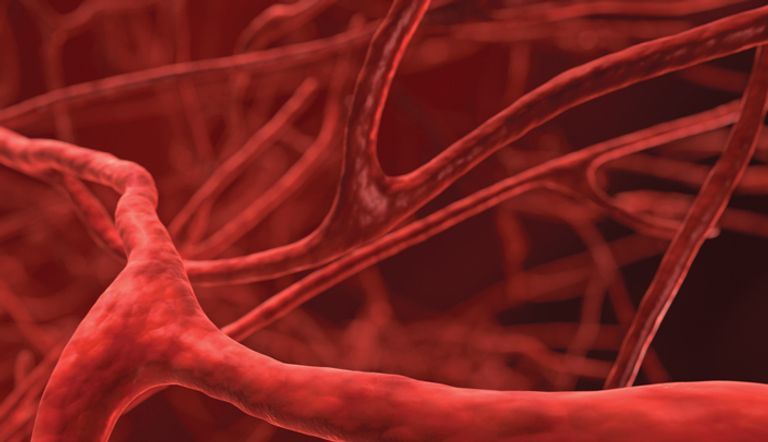 أمراض الأوعية الدموية تقود إلى الأزمات القلبية