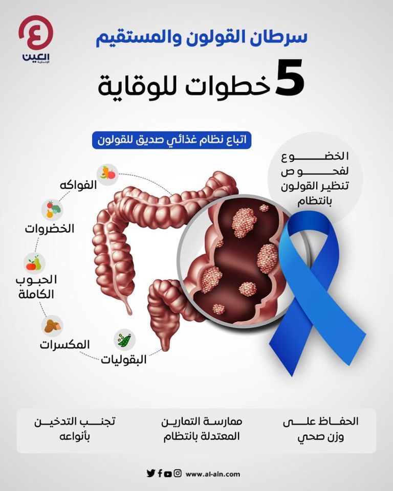 مريض يخضع لتنظير القولون 