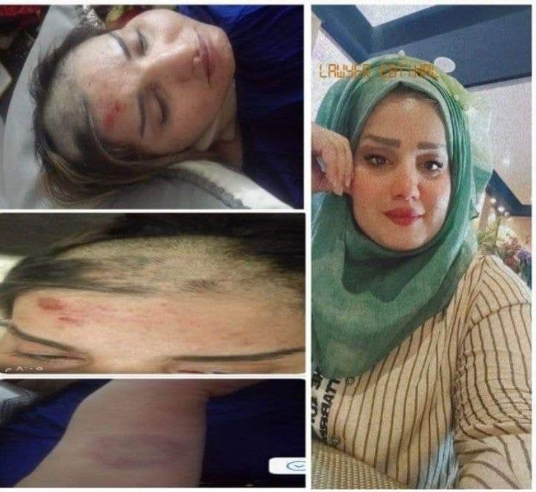 الفرطوسي قبل وبعد تعرضها للتعنيف من قبل أشقائها