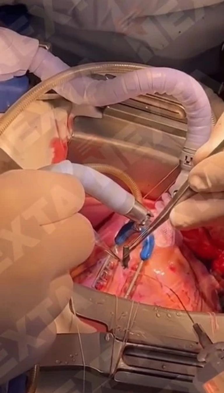 الجندي الأوكراني مع الأطباء بعد الجراحة - ذا صن