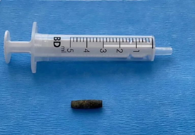 الجندي الأوكراني مع الأطباء بعد الجراحة - ذا صن