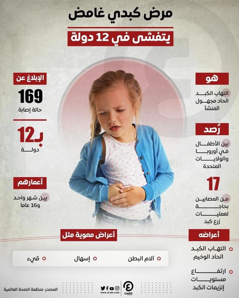 مرض كبدي غامض يتفشى في 12 دولة