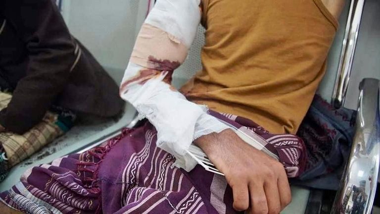 أطفال يمنيون يقفون أمام سيارة مدمرة جراء التفجير