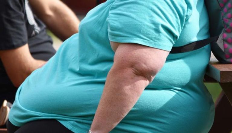 النساء البدناء أكثر عرضة لكسور العظام