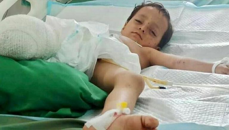 طفل يمني أصيب بقصف حوثي بتعز - أرشيفية
