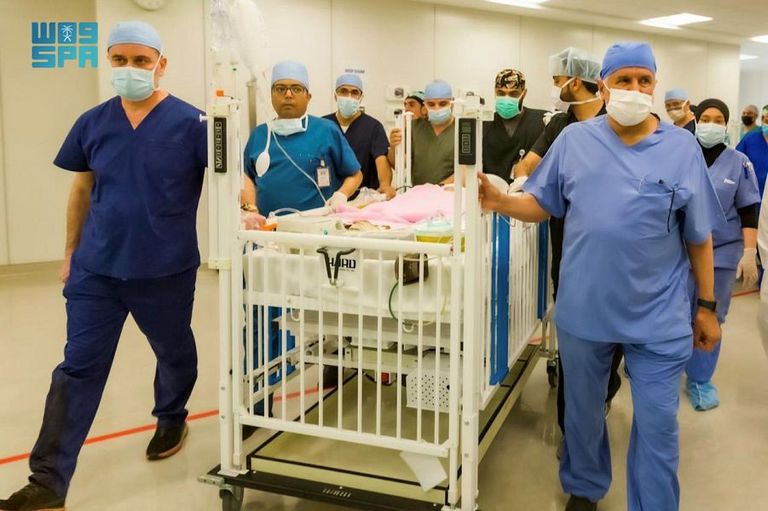 جراحة فصل التوأم