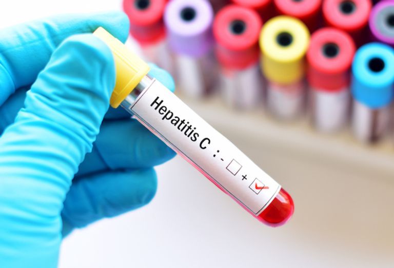 التهاب الكبد الحاد نادر بين الأطفال