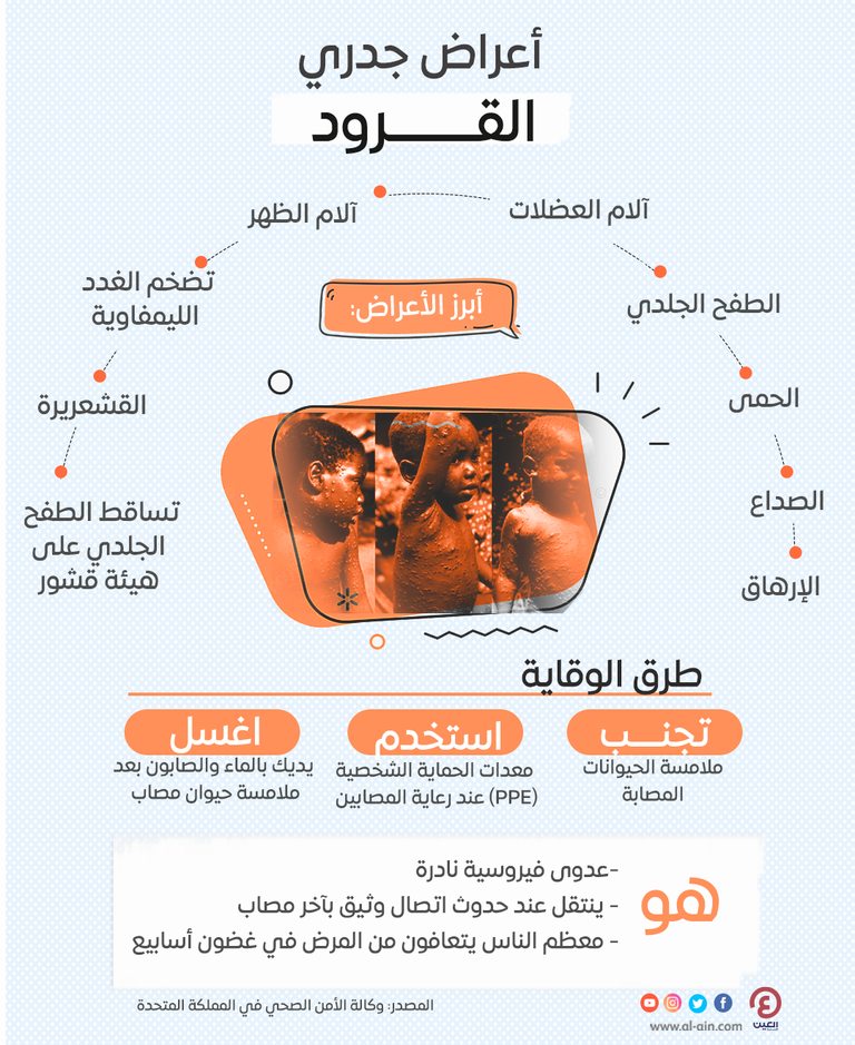 جدري القرود