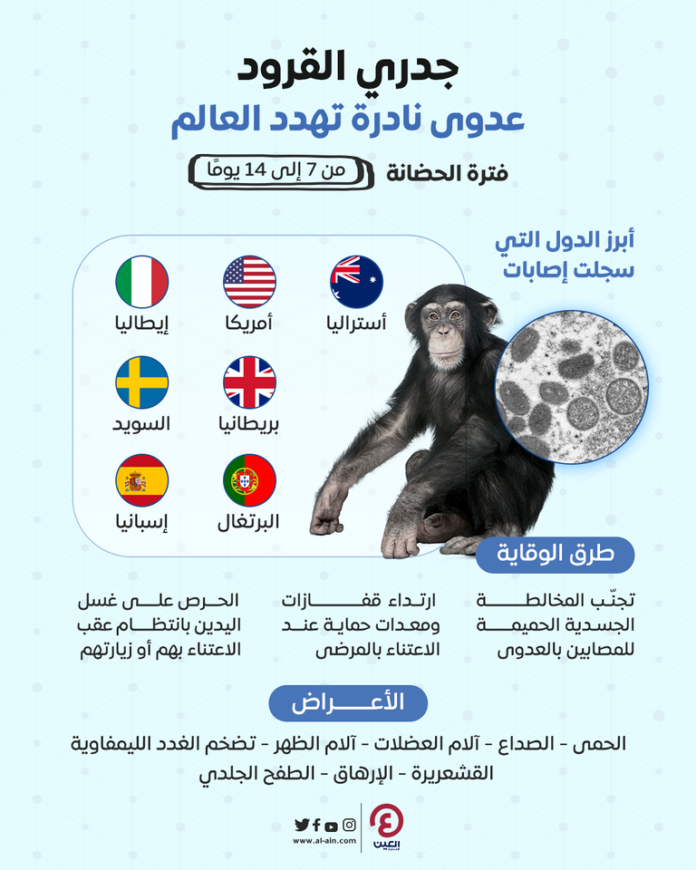 جدري القرود