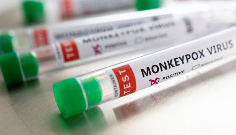 فيروس جدري القرود يواصل الانتشار حول العالم