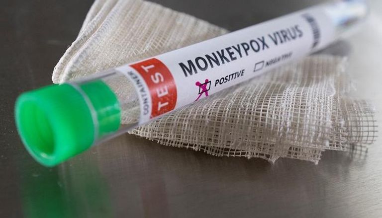 جدري القرود يظهر في التشيك