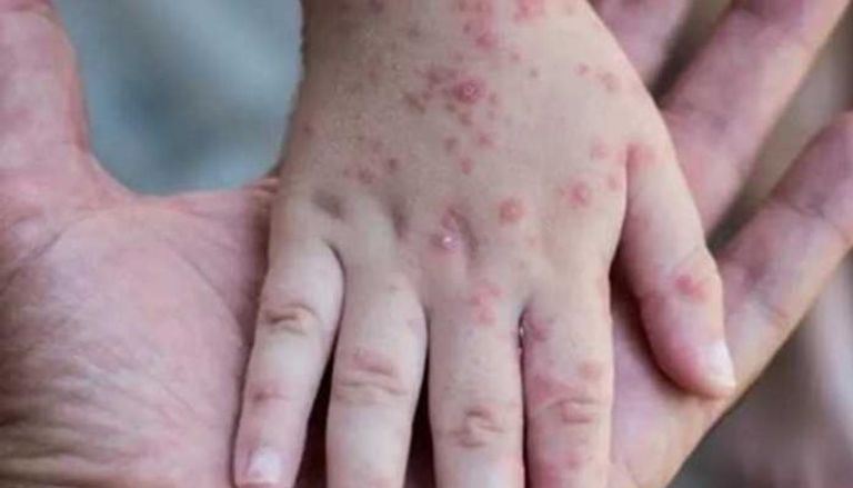 شركة موديرنا لصناعة الأدوية