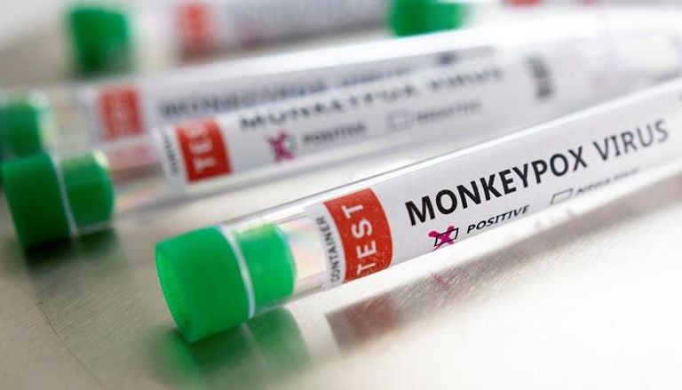 جدري القرود عدوى فيروسية نادرة مشابهة للجدري البشري