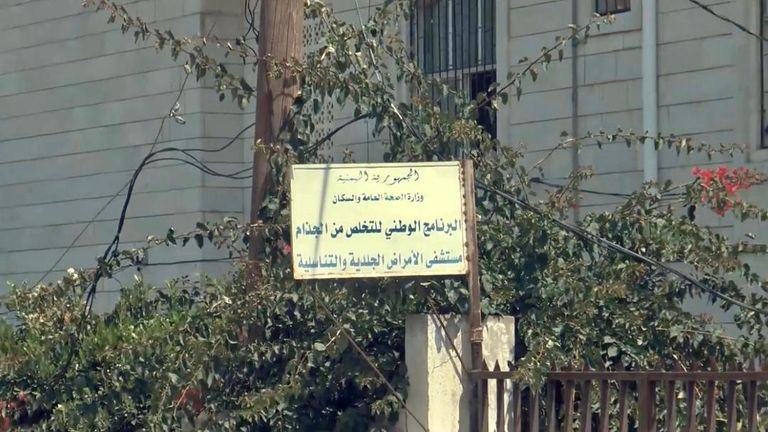 مستعمرة للجذام في اليمن