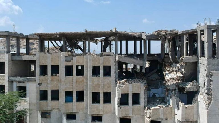 مستعمرة للجذام في اليمن