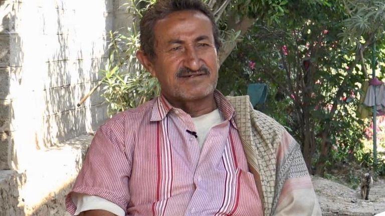 مستعمرة للجذام في اليمن