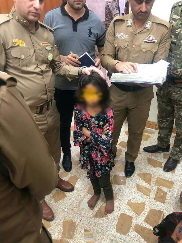 الطفلة تعرضت لضرب وحشي من والدها