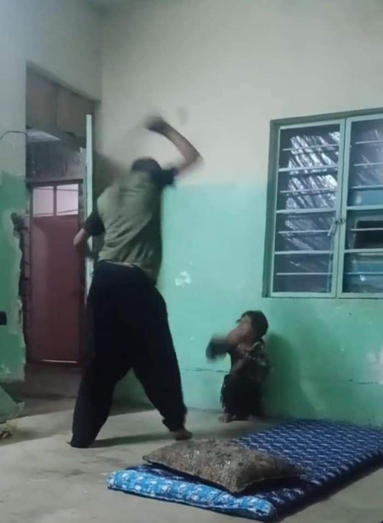 الطفلة تعرضت لضرب وحشي من والدها