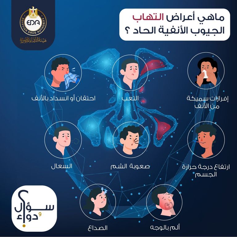 أعراض التهاب الجيوب الأنفية أسباب وأعراض التهاب الجيوب الأنفية