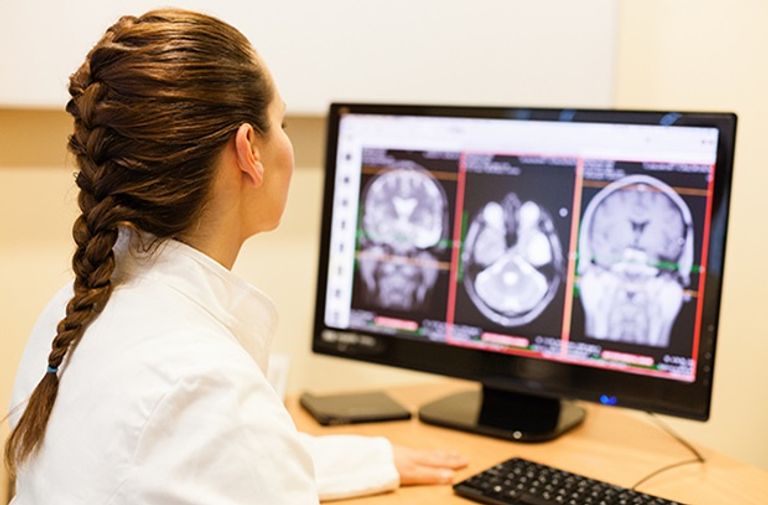 يمكن للورم أن يستثير الخلايا العصبية في الدماغ بشدة - أرشيفية