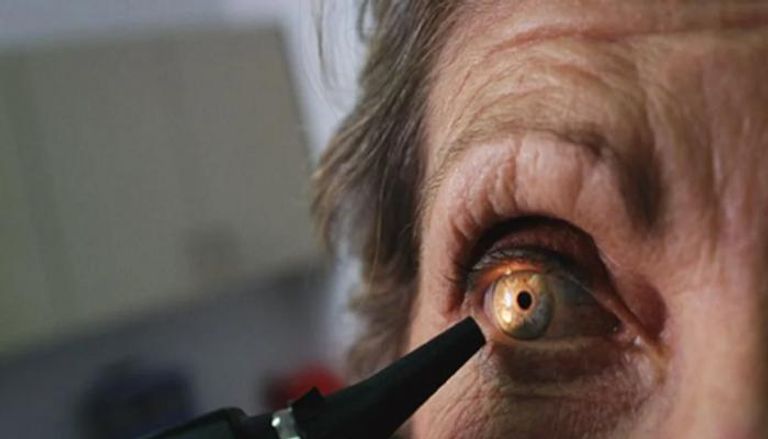 الكشف عن علاقة مثيرة للاهتمام بين النظام الغذائي وصحة العين والعمر