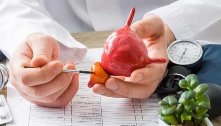 علاقة الألبان بسرطان البروستاتا ترجع للهرمونات