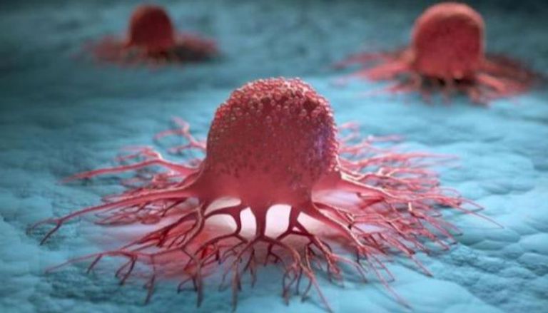 المستشعر يسهم في الاكتشاف المبكر لخلايا السرطان