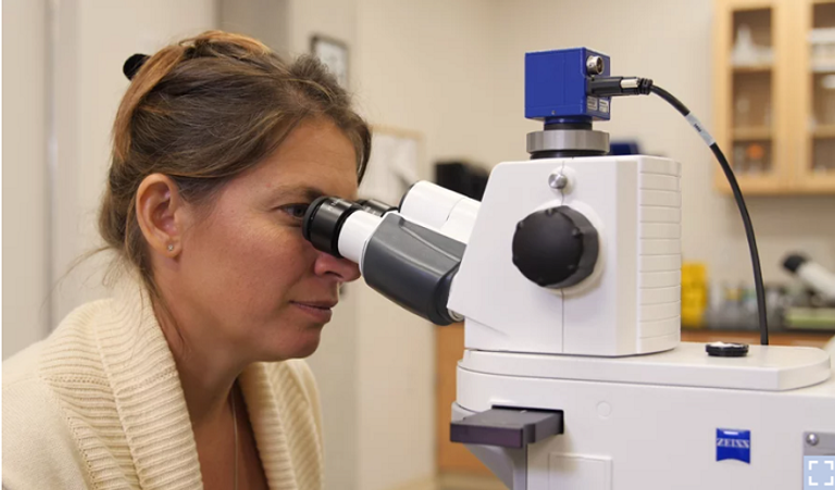 عثة الوجه تعيش داخل مسامك ولا يمكنك غسلها