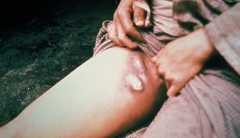 القوارض خاصة الفئران مسؤولة عن نقل الطاعون