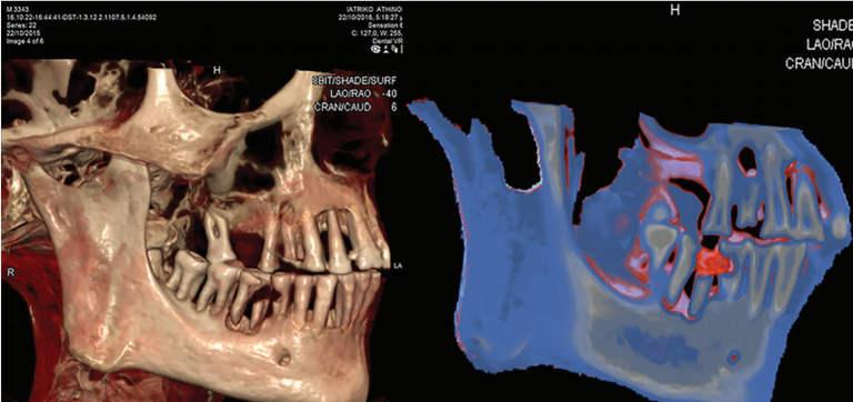 المومياوات حول العالم كشفت تاريخ الأمراض- أرشيفية