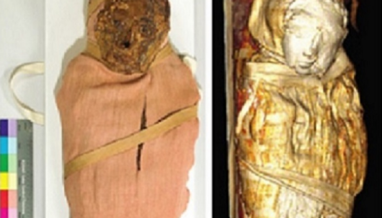 المومياوات حول العالم كشفت تاريخ الأمراض- أرشيفية
