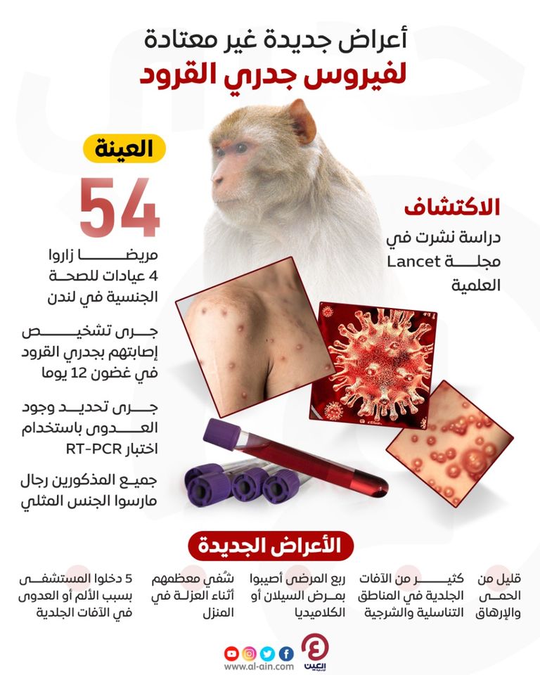 أعراض غير معتادة لجدري القرود