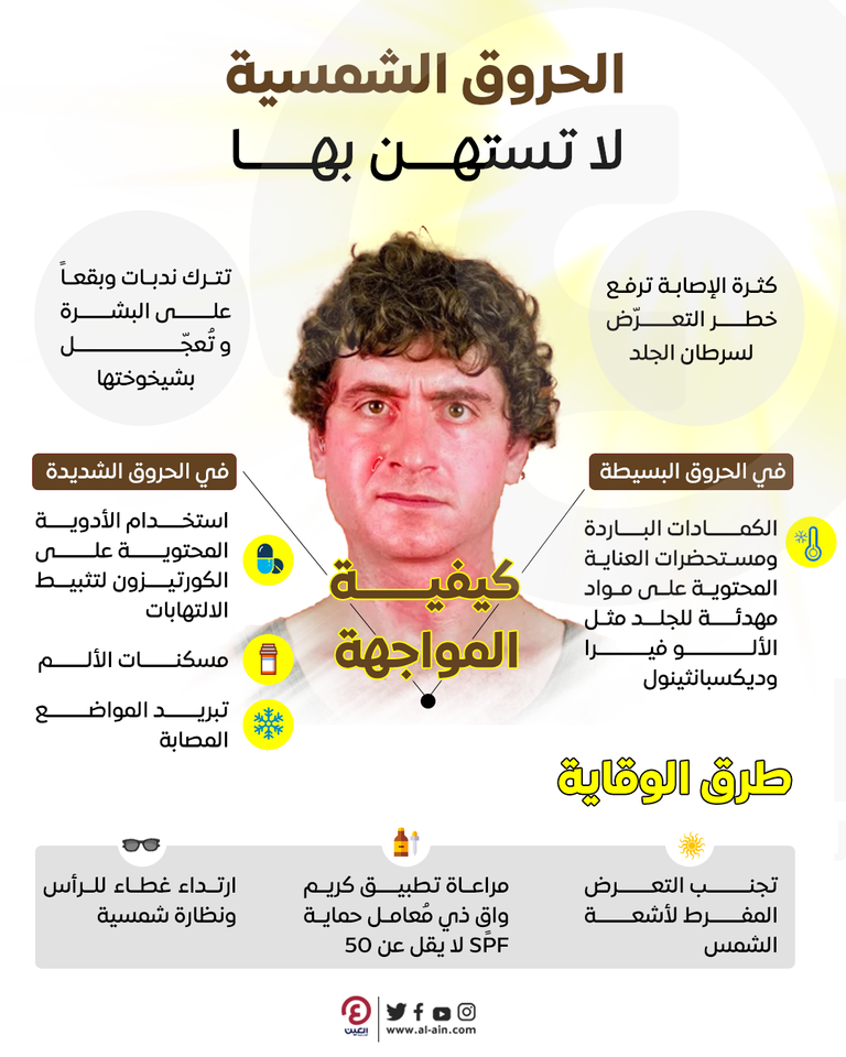 طرق الوقاية من الحروق الشمسية