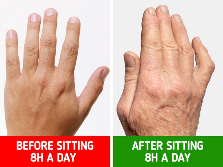 أعراض تحذرك من الجلوس كثيرًا