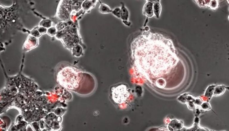 كورونا يشق طريقه من الأنف نحو الدماغ