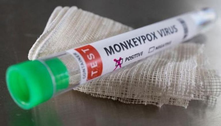 الطفح الجلدي أبرز أعراض الإصابة بجدري القرود - أرشيفية