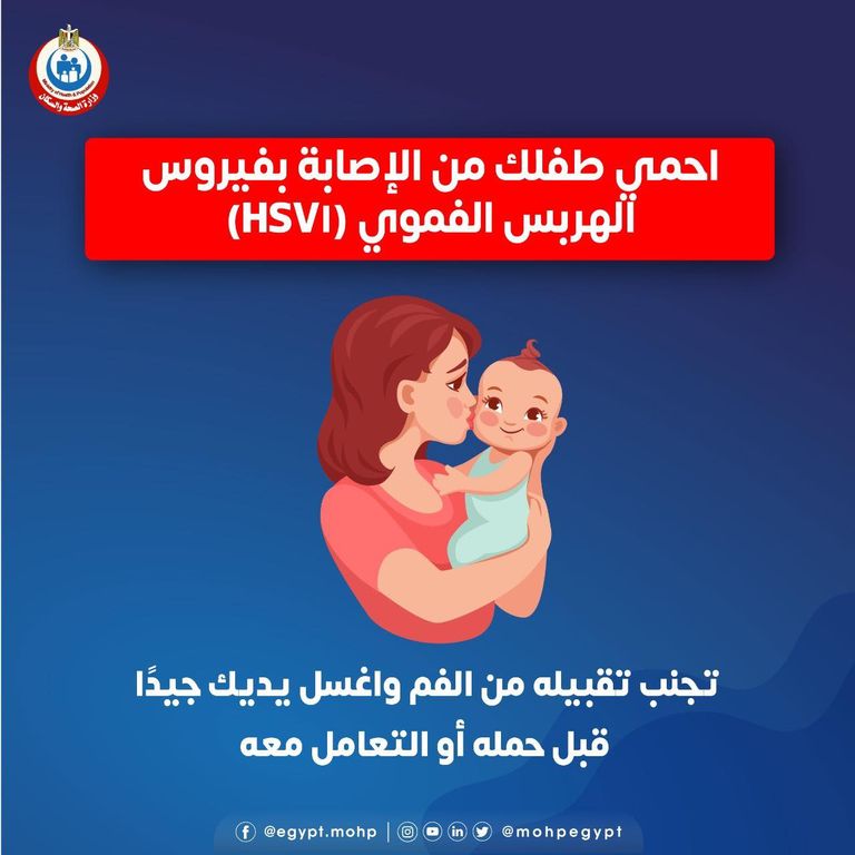 طفل مصاب بقروح من الهربس الفموي