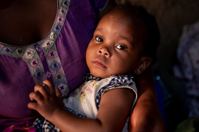 طفلة مصابة بالإيدز