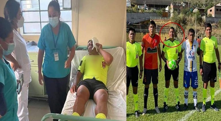 حكم مهدد بفقدان بصره