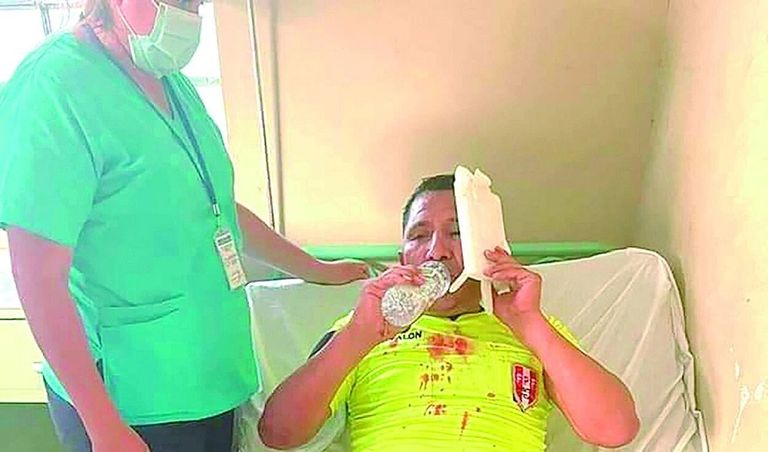 حكم مهدد بفقدان بصره