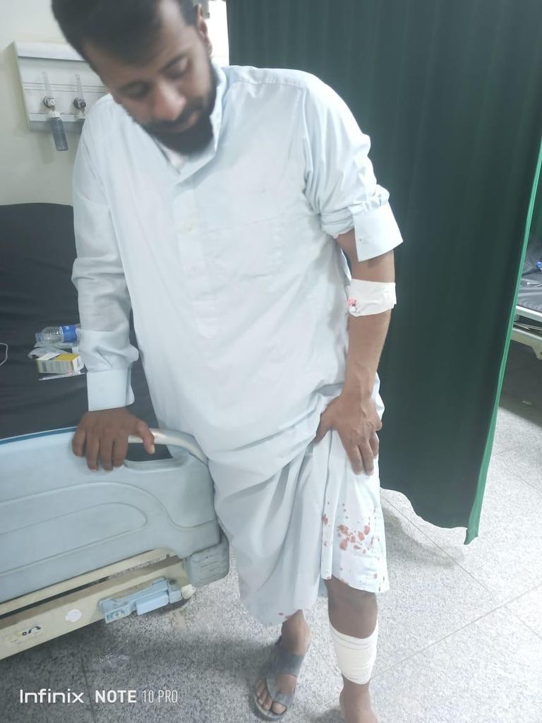 أحد المصابين يتلقى الإسعاف في أحد المستشفيات