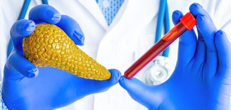 سرطان البنكرياس في تحليل الدم شخص مصاب بمرض سرطان البنكرياس... تعبيرية