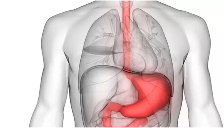 رسم تخطيطي يوضح الوضع الأصلي للمعدة بالنسبة إلى الجسم 
