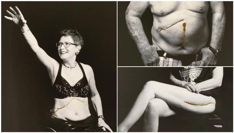 أعمال الفنانة والطبيبة البريطانية كارول هوليداي