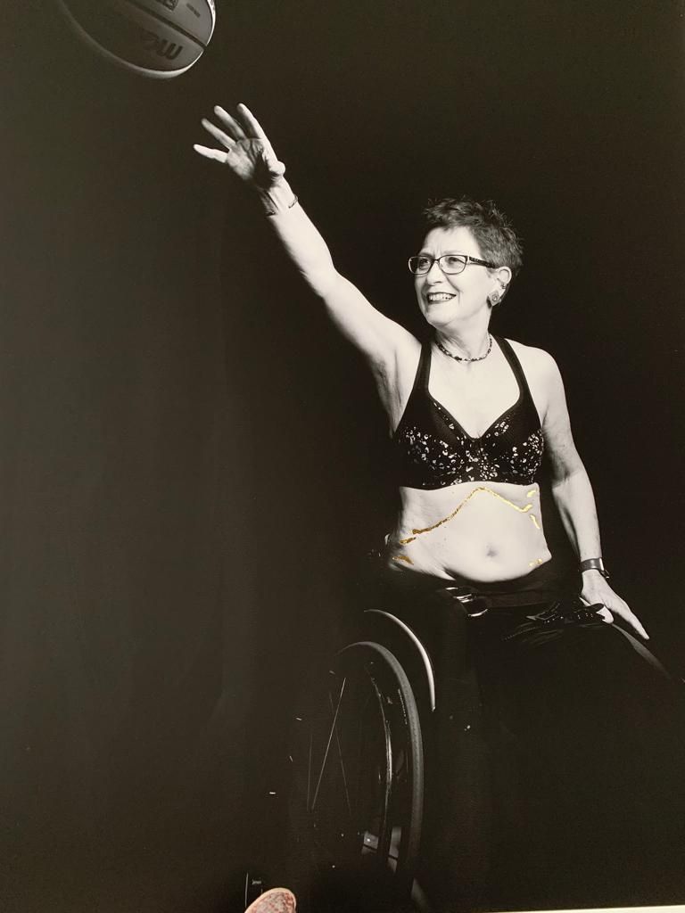 أعمال الفنانة والطبيبة البريطانية كارول هوليداي